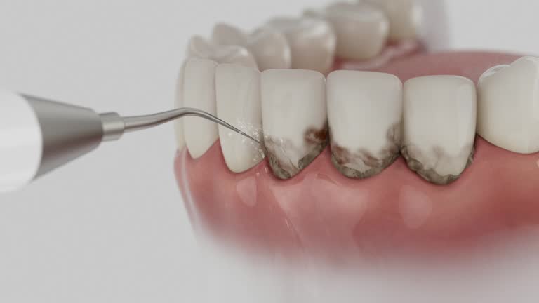 Reliable Dental Implants contractor in Atmore, AL by Smile Center Dentistry